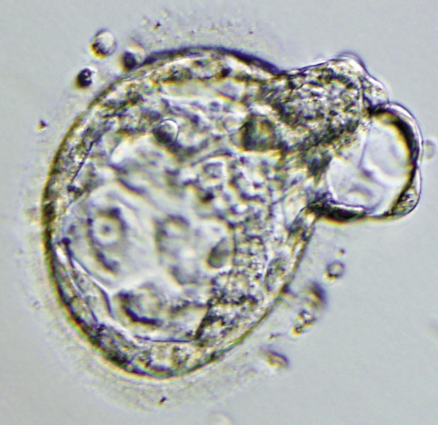 Varajases staadiumis embrüo