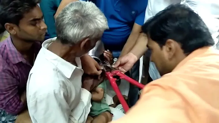 Üheaastasele india poisile jäi pott pähe kinni