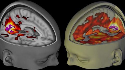 Uuring: LSD aitab ajus «harmoonilist» korda luua