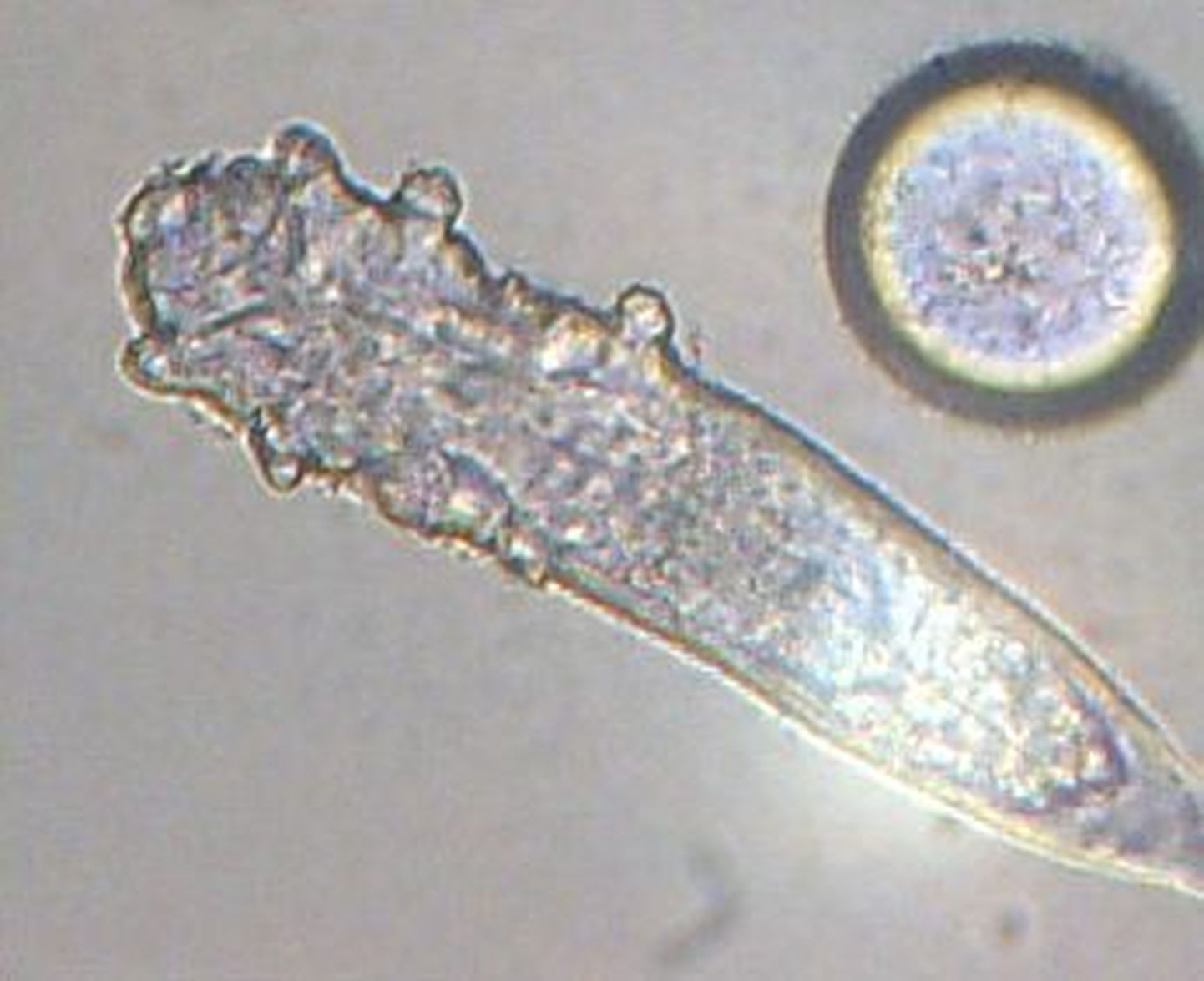 Demodex folliculorum