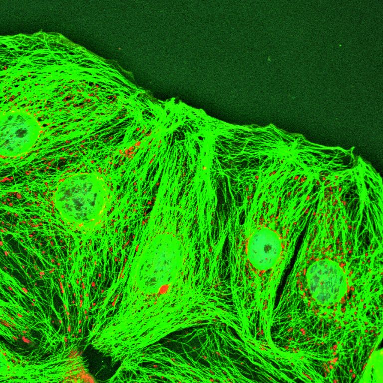 Jämesoole vähirakud pärast võihappega inkubeerimist. Punasega on värvitud vähirakkude mitokondrid, rohelisega aga rakkude sisetoese moodustav tsütoskelett ja helesinisega rakkude tuumad