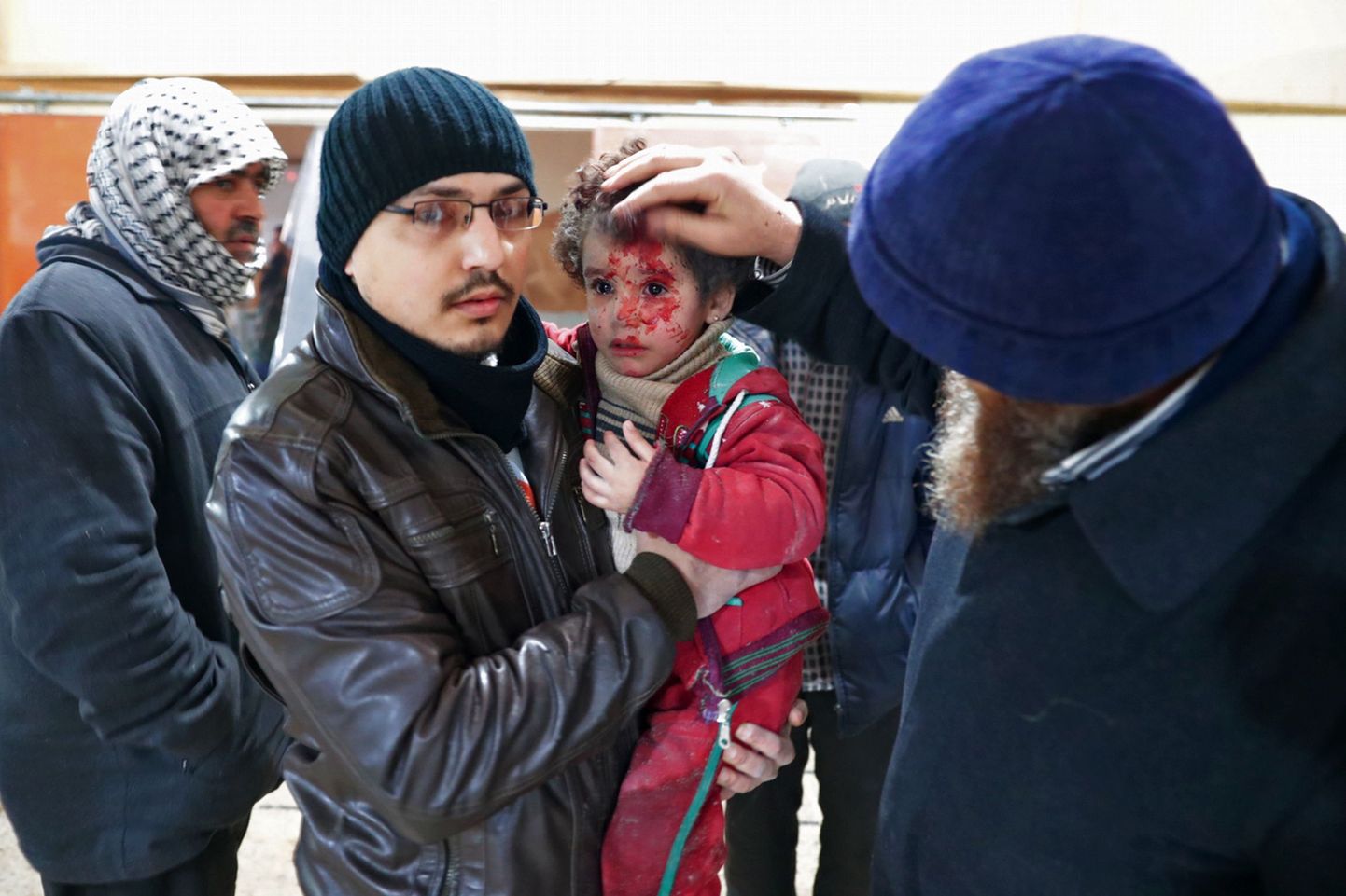 Viga saanud Süüria laps 29. detsembril 2016 pärast järjekordset pommitamist Douma linnas, mis on mässuliste käes.