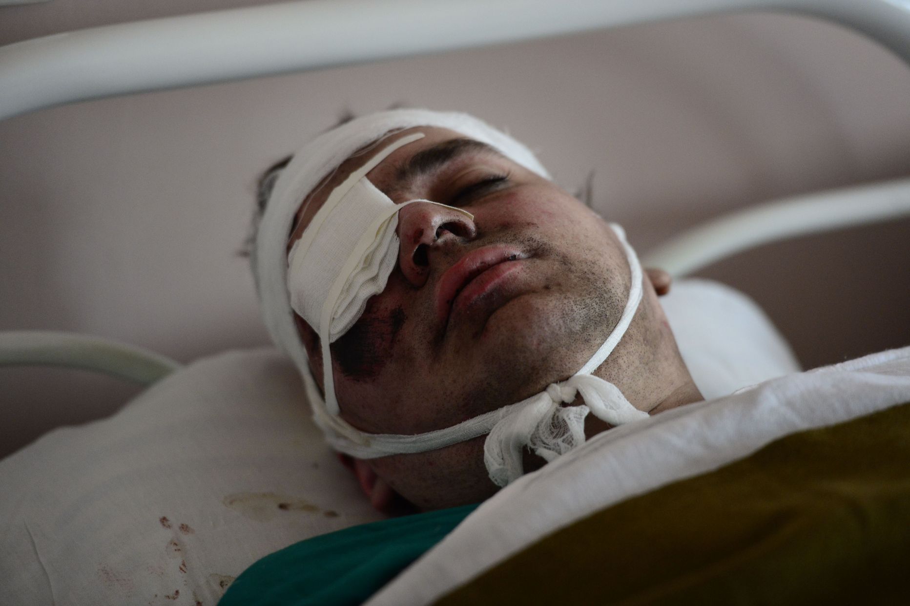 Zasjadko-nimelises šahtis viga saanud kaevur Donetski haiglas.