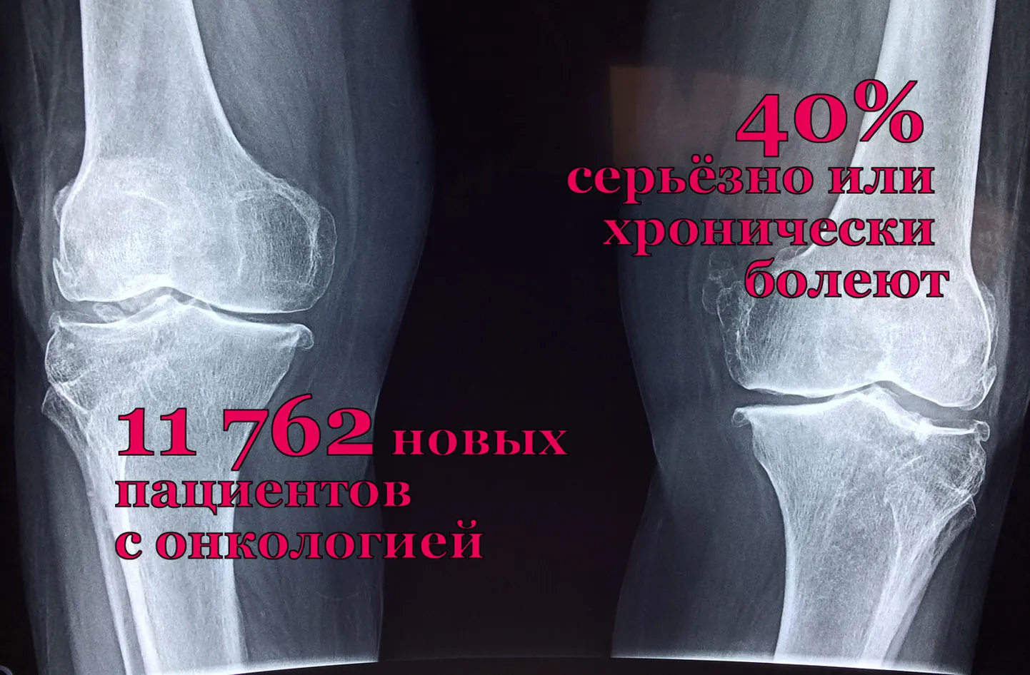 Фото статьи