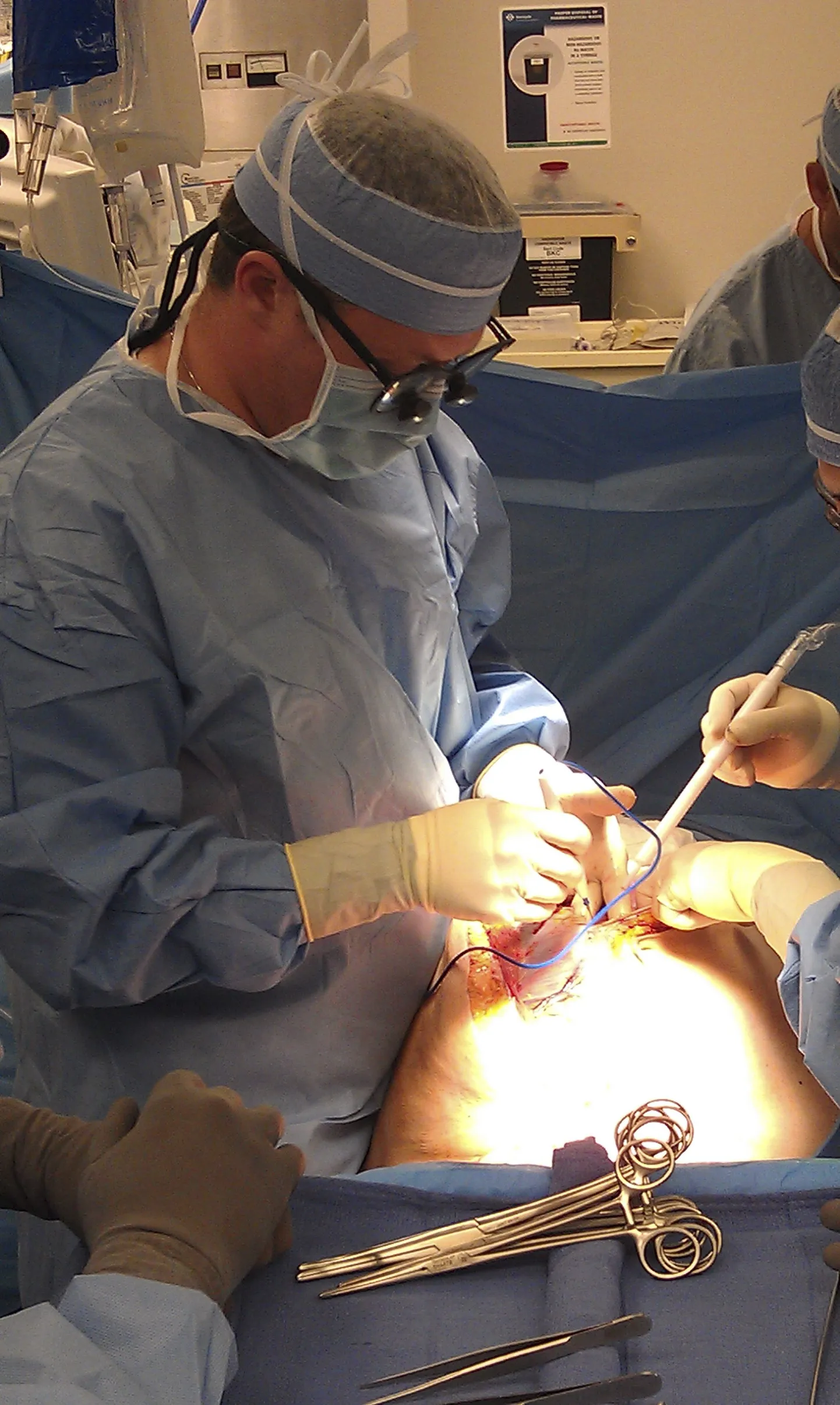 Operatsioon