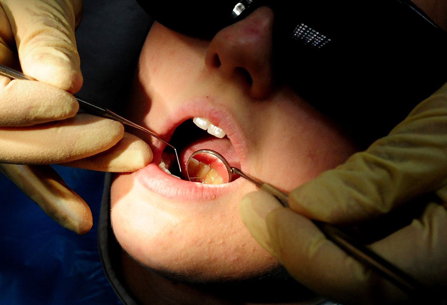 Ravimata hambad viivad teiste tervisemuredeni.
