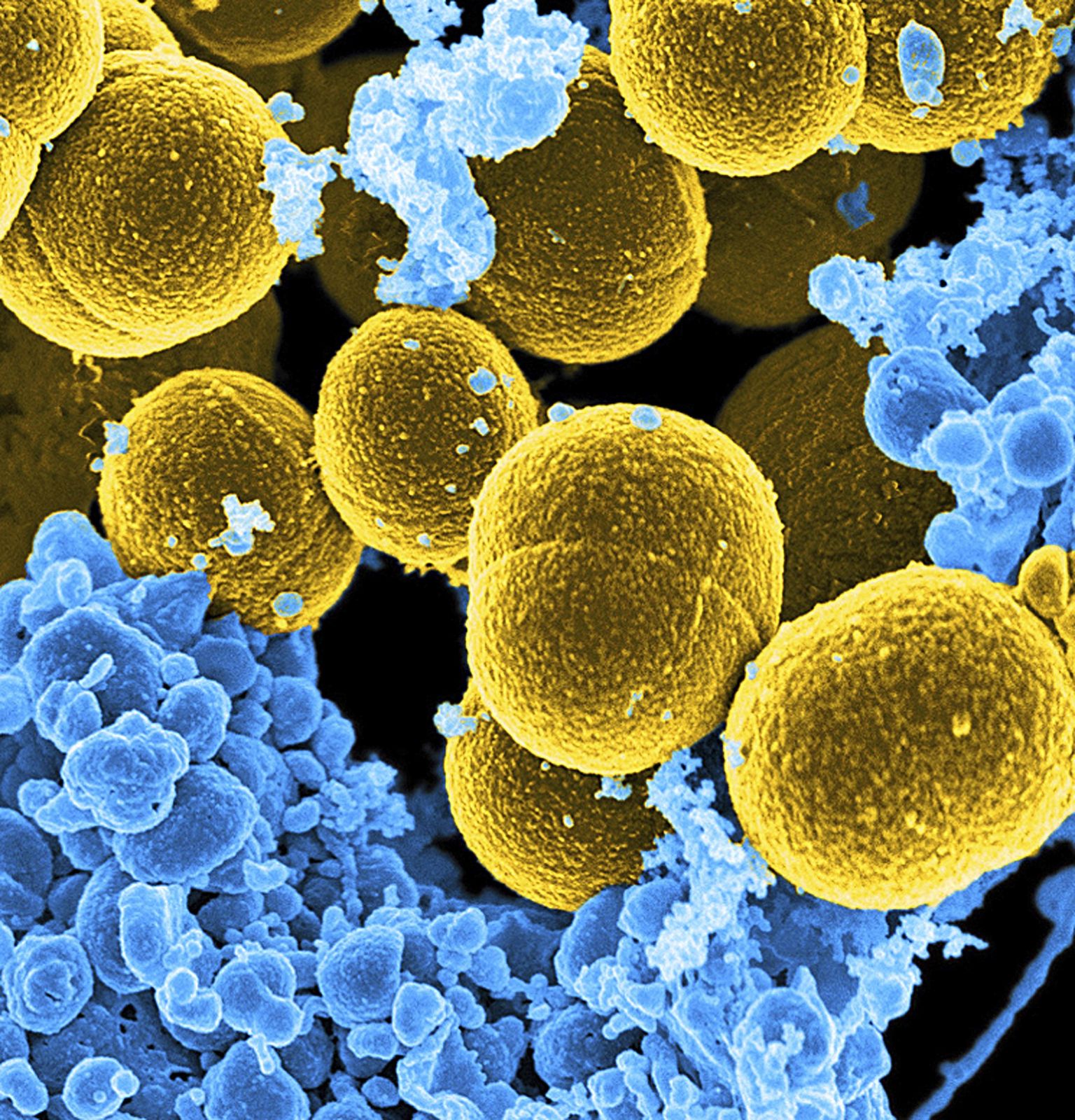 WHO raport näitab esimest korda konkreetselt millised bakterid on antibiootikumide resistentsuse arenemise osas kõige ohtlikumad.