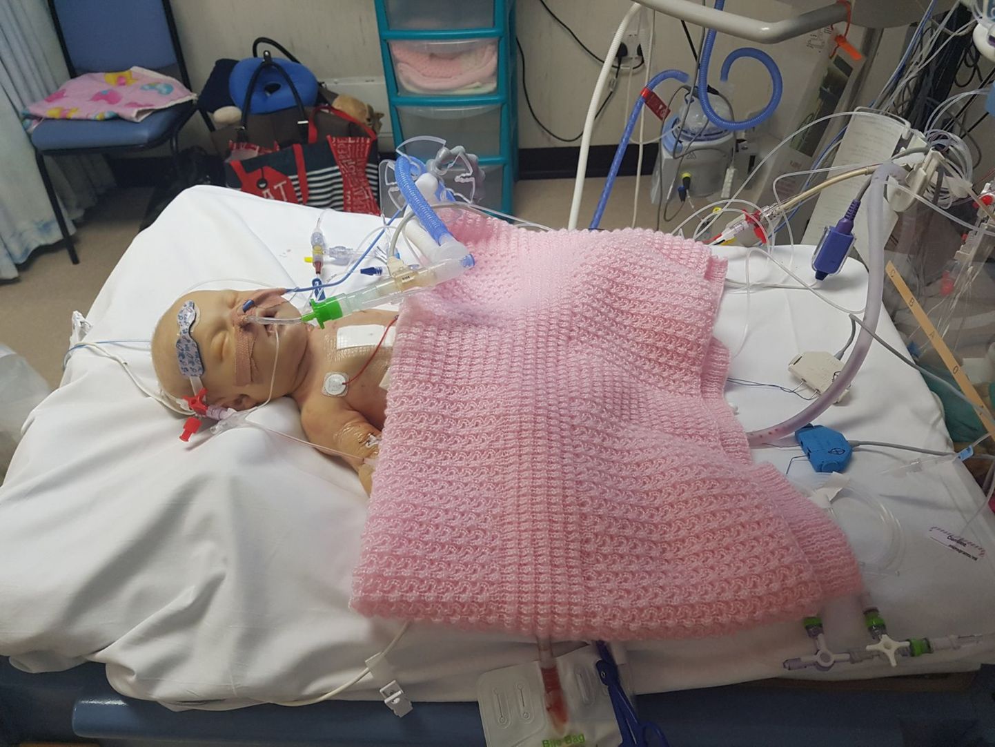 Pooliku südamega sündinud Lacey-Janet Suttor Parki haiglavoodis pärast esimest lahtist südameoperatsiooni.