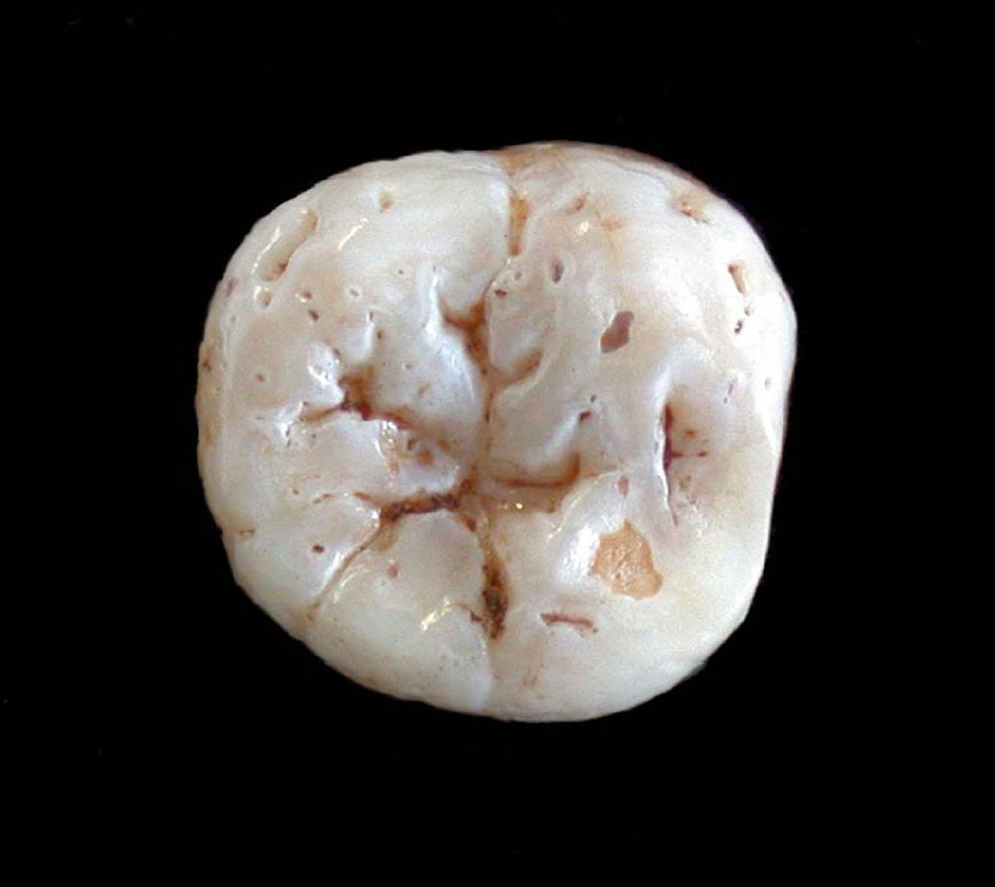 40 000 aasta tagasi elanud neandertallasele kuulunud hamba uurimine kinnitas, et need esiajaloolised inimesed polnud paiksed