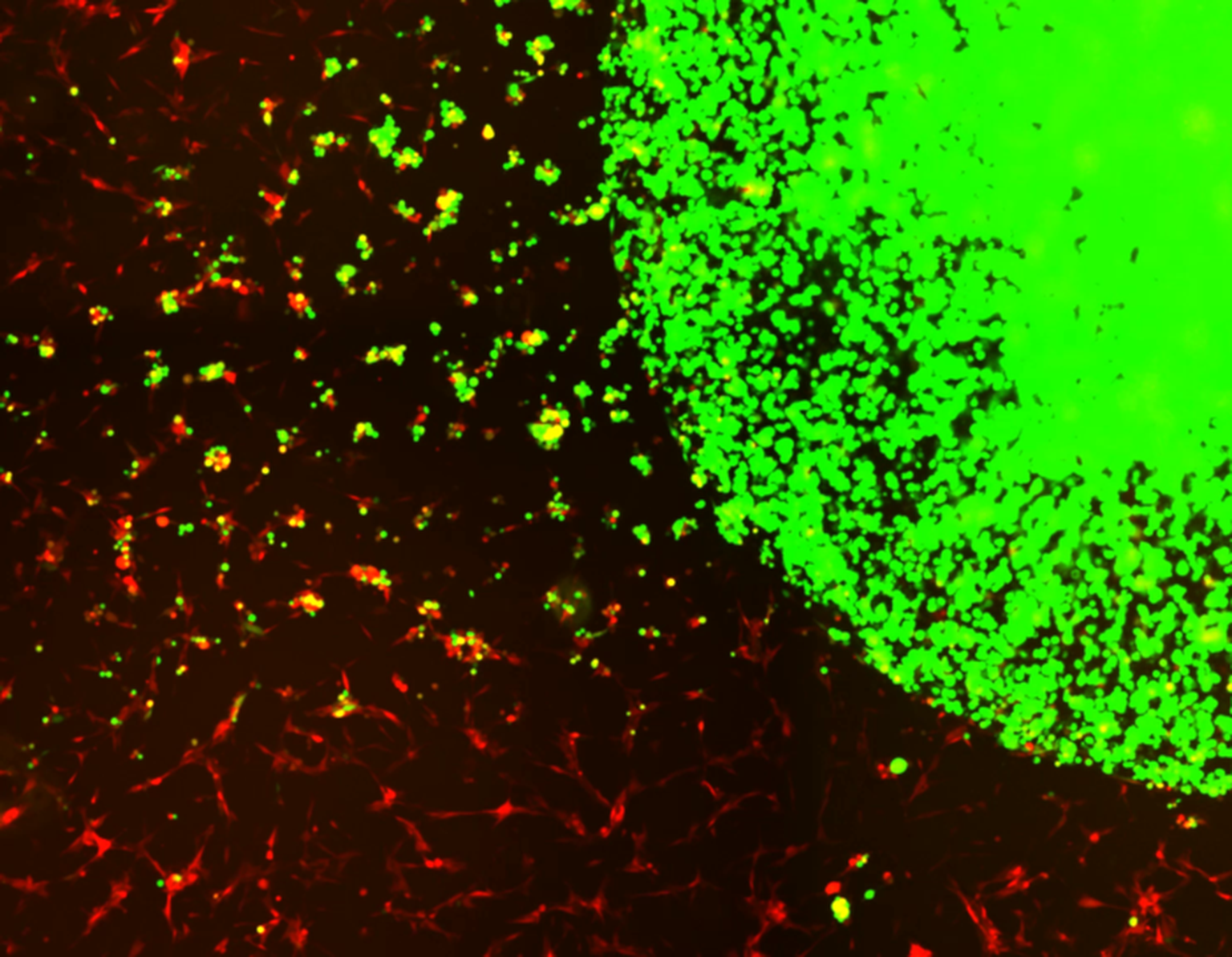 Geeli kapseldatud tüvirakud (rohelised) tuvastavad ja tapavad glioblastoomi rakke (punased).