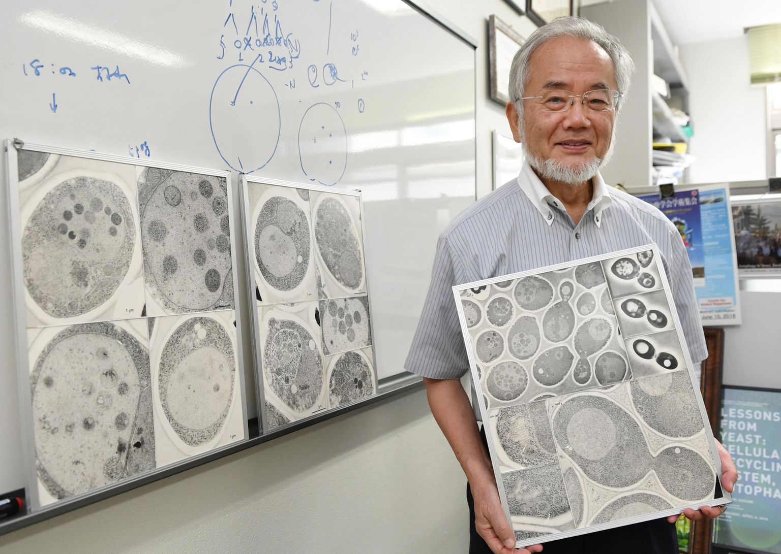 Eile Nobeli meditsiinipreemiaga pärjatud jaapani rakubioloog Yoshinori Ohsumi alustas pärmiseente autofaagia uurimist 1990. aastatel. Tänaseks on ta teinud kindlaks rakkude jääkainete taaskäitlemise mehhanismid ja ka geenid, mis neid protsesse mõjutavad. Tema avastused võivad tulevikus viia nii Parkinsoni haiguse ravi kui ka vananemise aeglustamiseni.