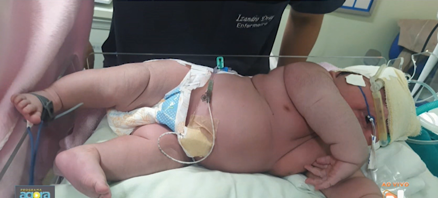 Beebi kaalus sündides üle 7 kilogrammi