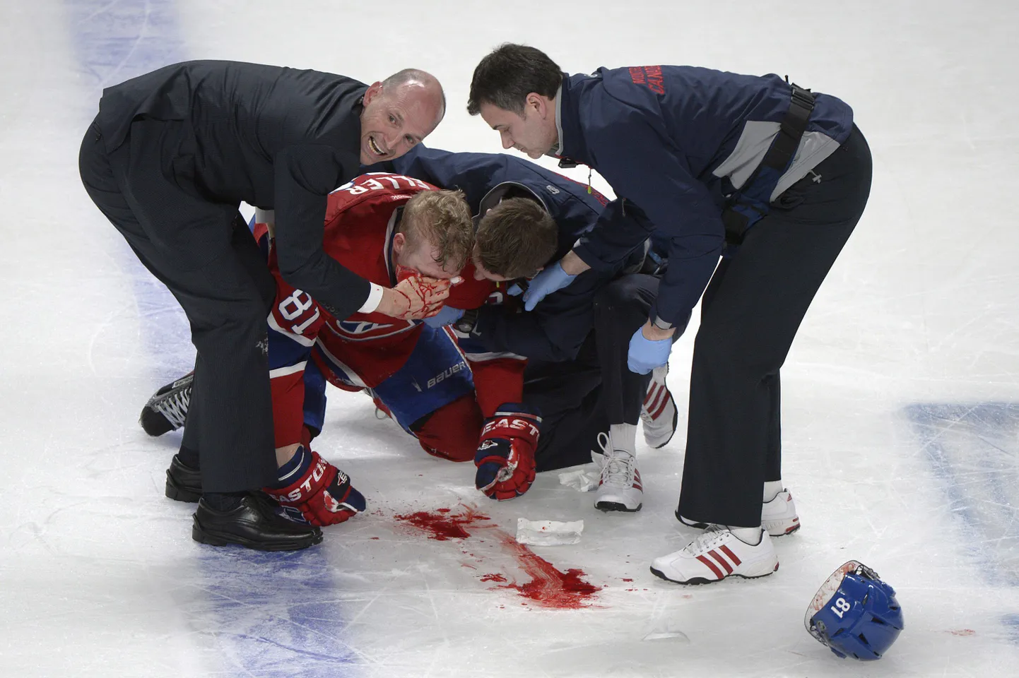 Хоккеист НХЛ получил травму.