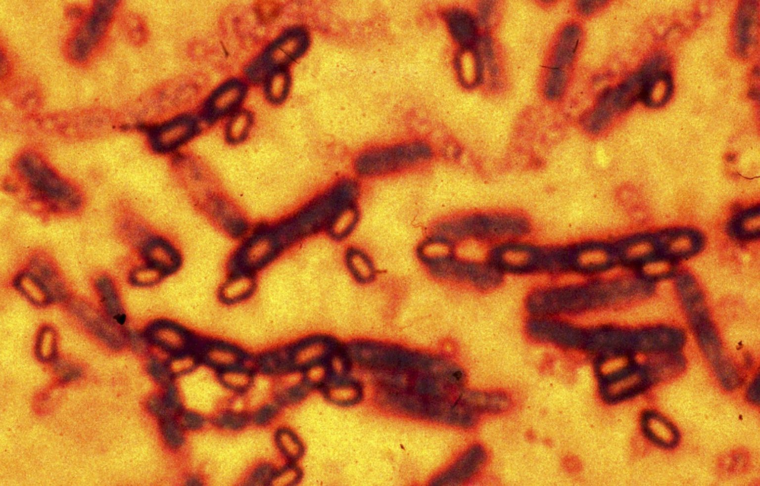 Antraksi bakterid mikroskoobi all.