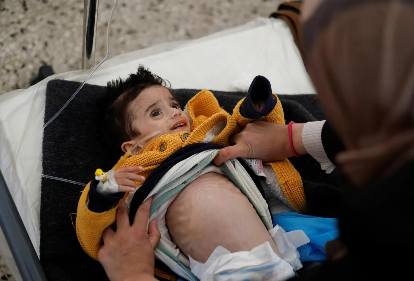 Rängas alatoitumuses Ahmed Qannan Gaza sektori lõunaosas asuva Rafah’ haiglas. Poiss on viie sõjakuuga kaotanud poole kehakaalust.