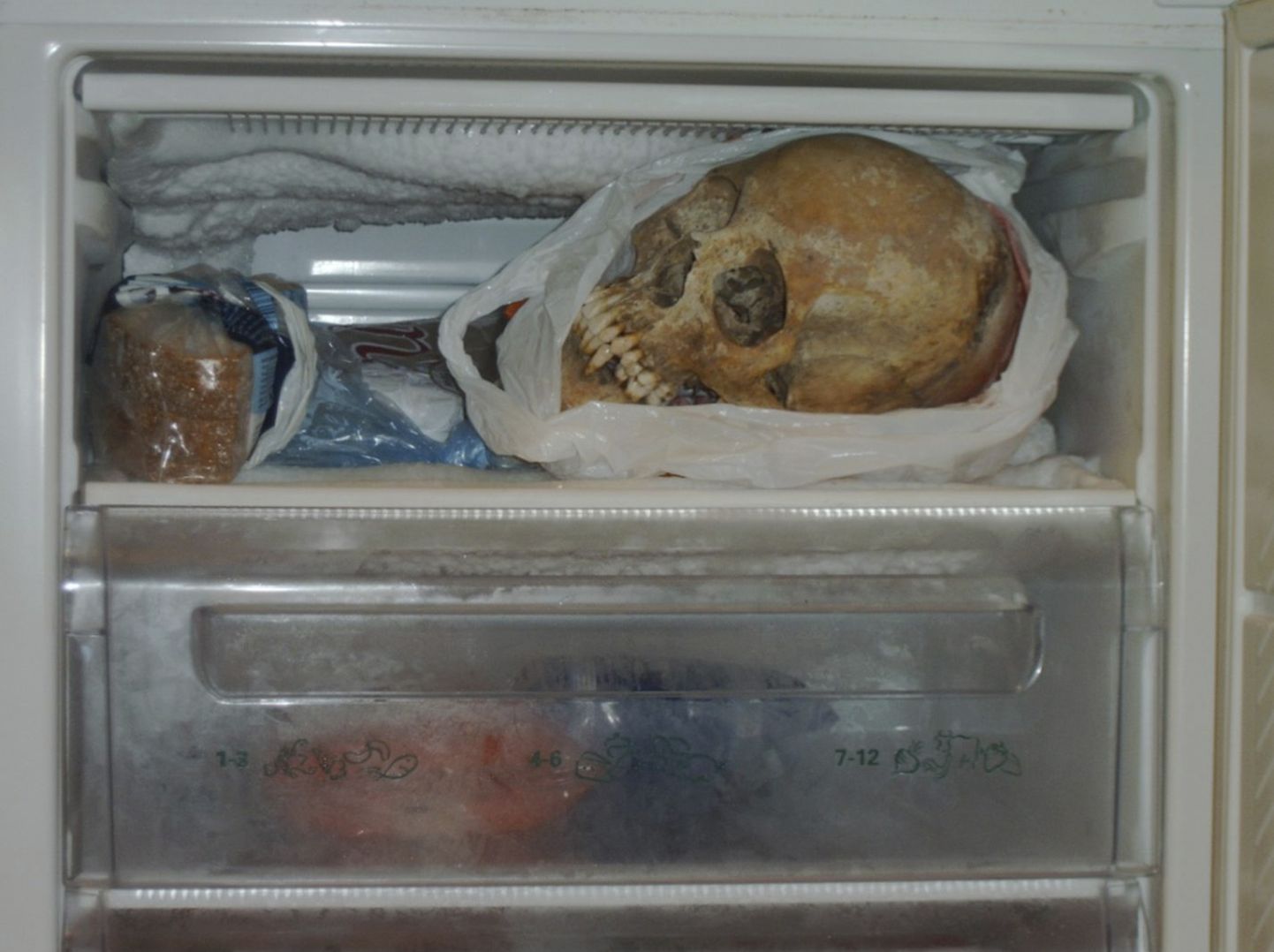 Õõvastavaid leide on tehtud ka varem. Pildil kujutatu leiti 2012. aastal Göteborgis elava 37-aastase naise külmikust.