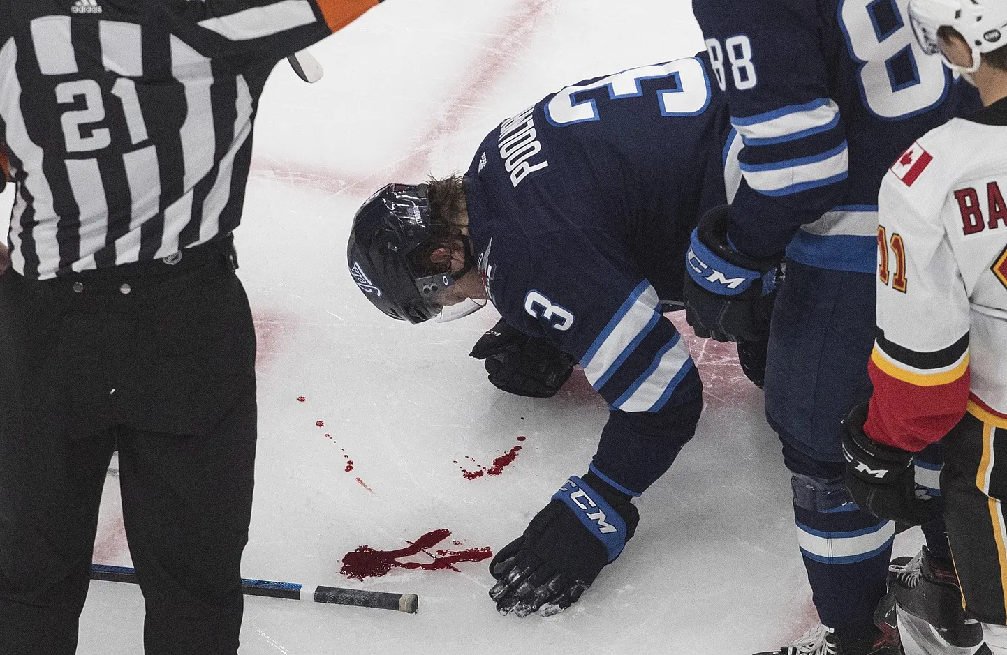 Winnipeg Jetsi kaitsja Tucker Poolman (3) sai takistas litri lendu oma näoga..