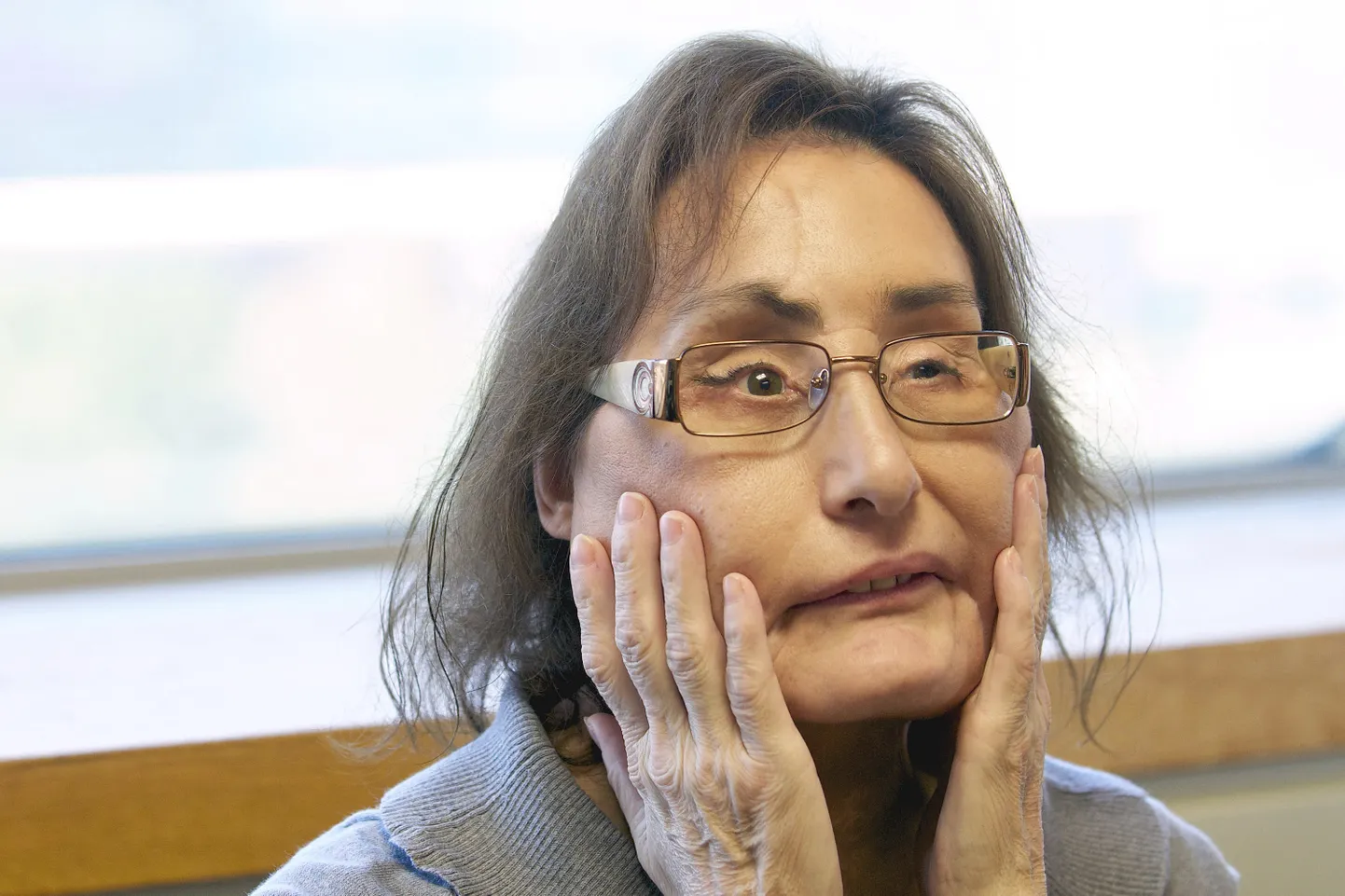 2008. aastal näosiirdamise operatsiooni läbi teinud Connie Culp paar aastat pärast protseduuri.