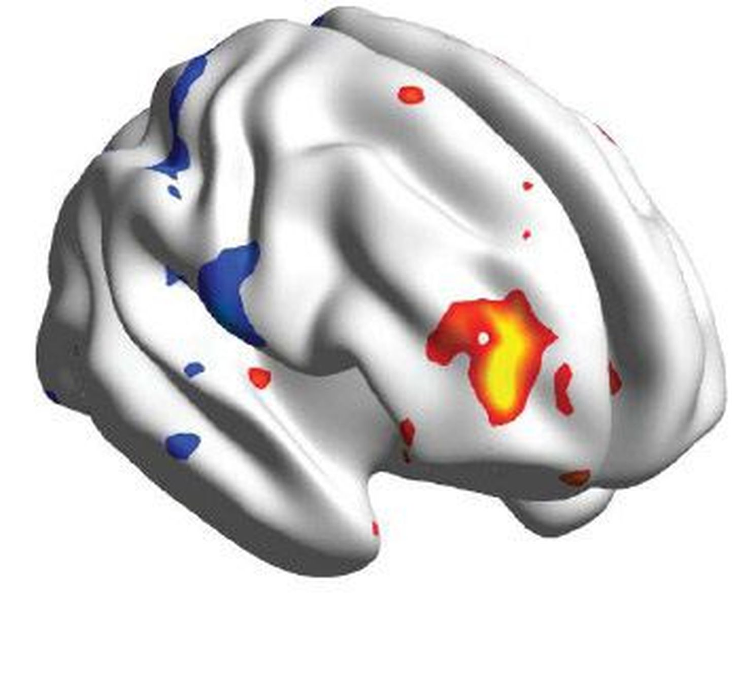 Kollase ja punasega tähistatud piirkonnas aktiviseerub aju platseeboefekti ajal.