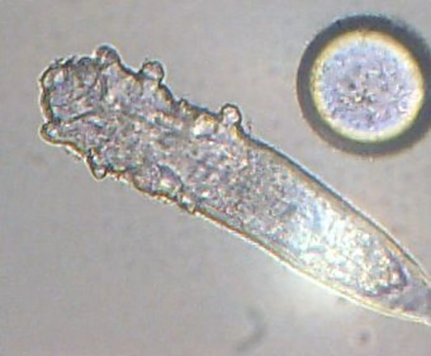 Demodex folliculorum
