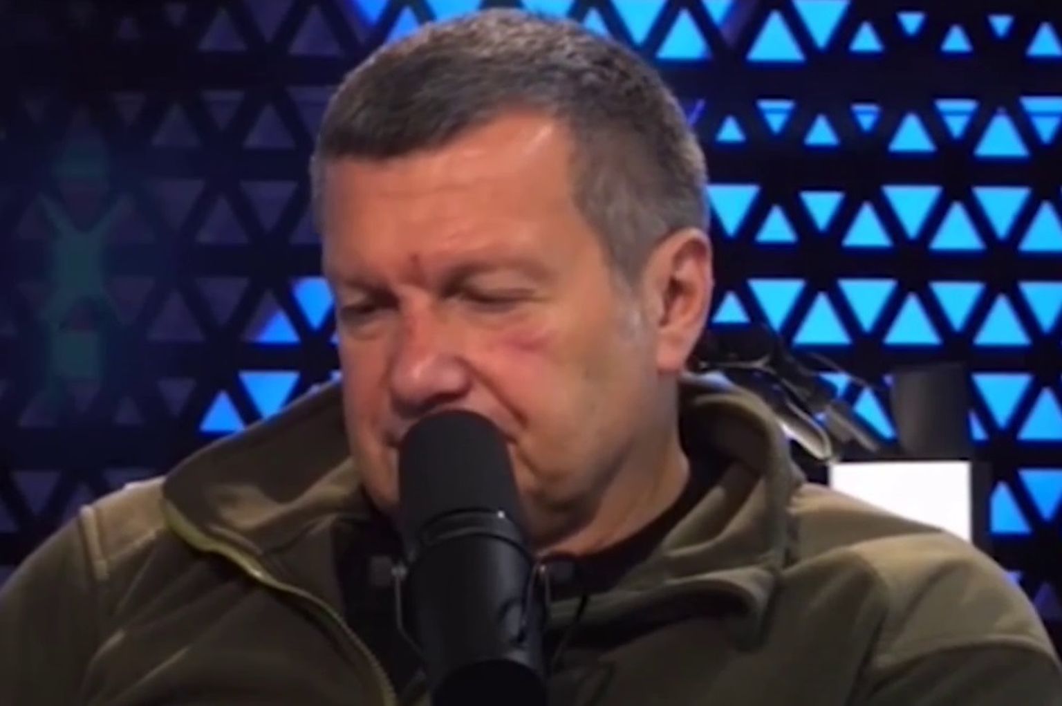 Телеведущий Владимир Соловьев со следами ссадин на лице