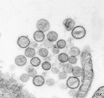 Hantaviiruse kujutis Tartu ülikooli arstiteaduse online-õppevahendis. / Allikas: http://virology-online.com/viruses/Hantaviruses.htm
