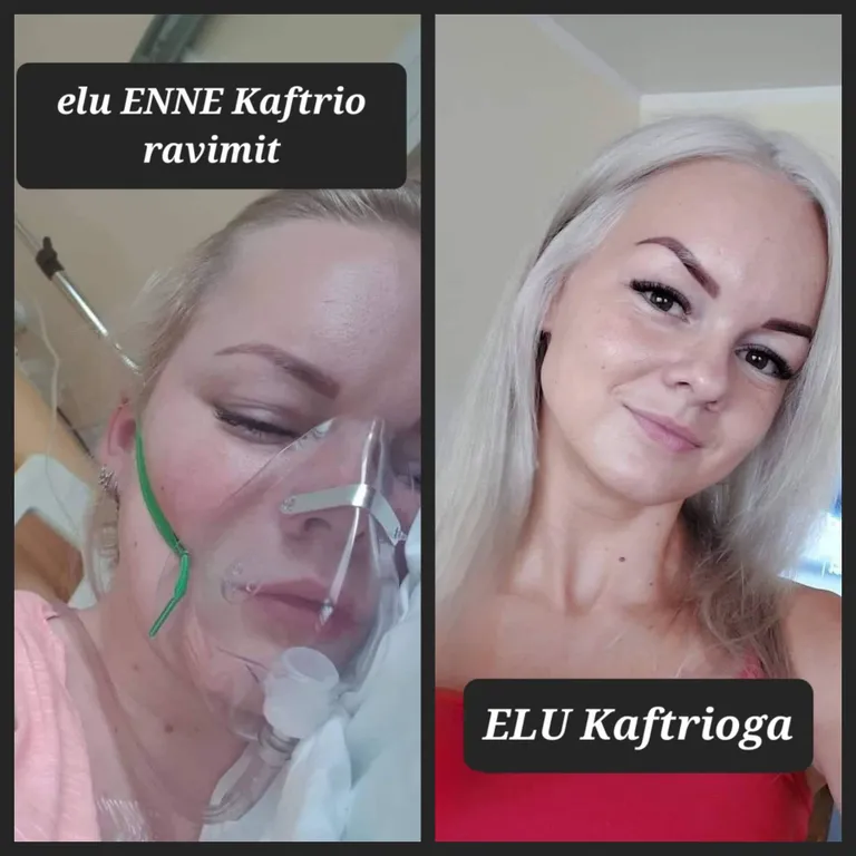 Maarja Tederi käekäik sõltub ravimitest.