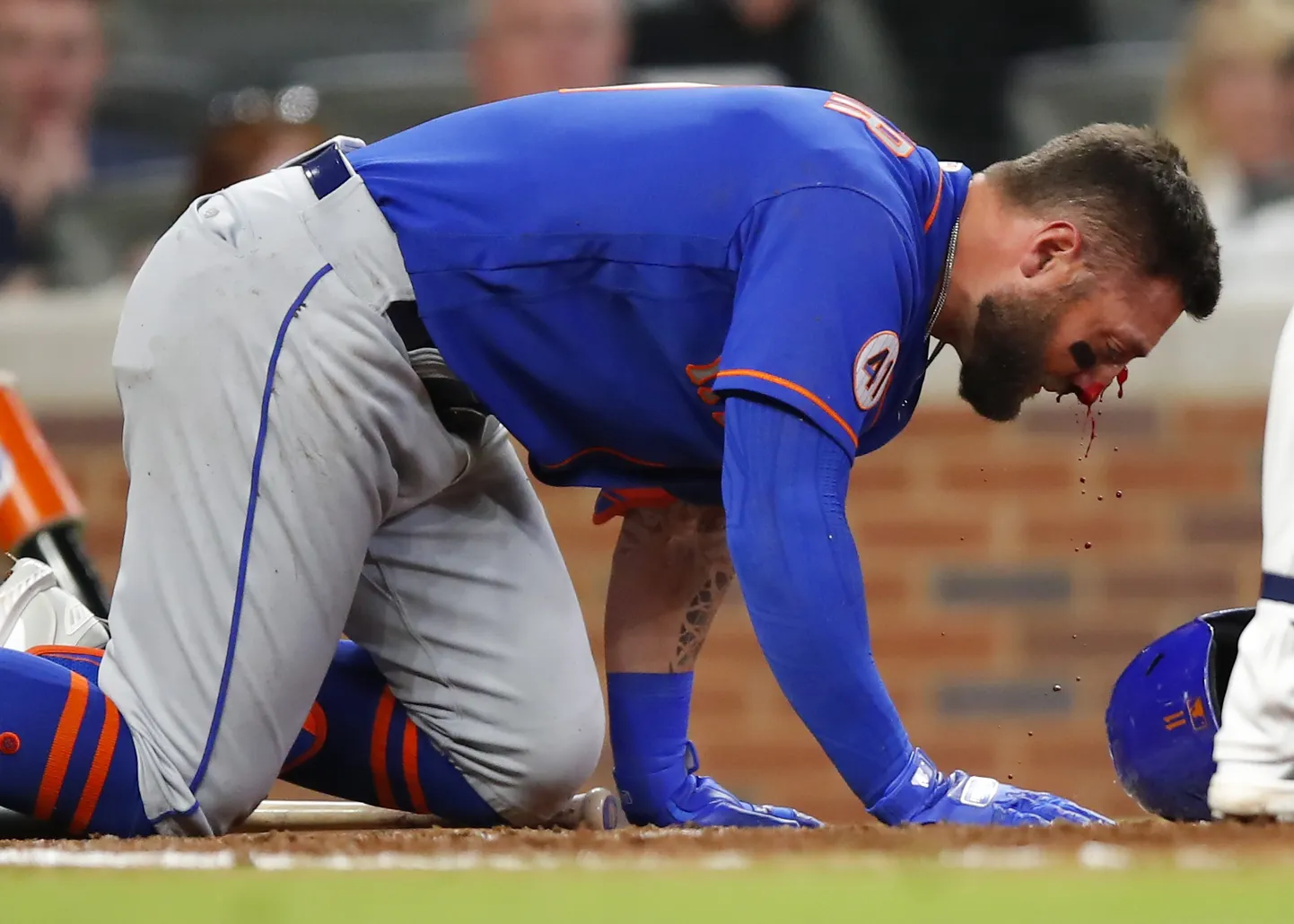 New York Metsi pesapallistaar Kevin Pillar sai läinud öises matšis palliga kohutava löögi vastu nägu.
