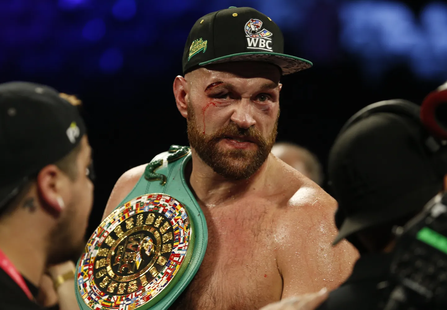 Tyson Fury.