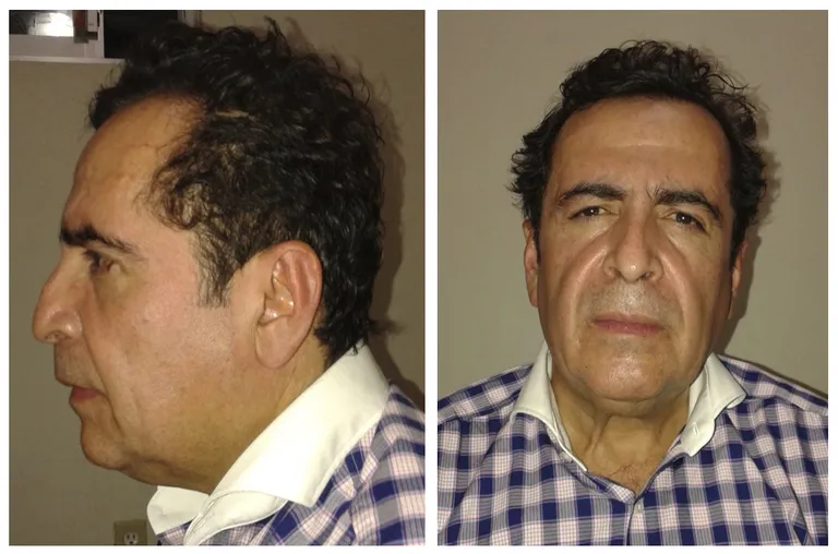 Héctor Beltrán Leyva.