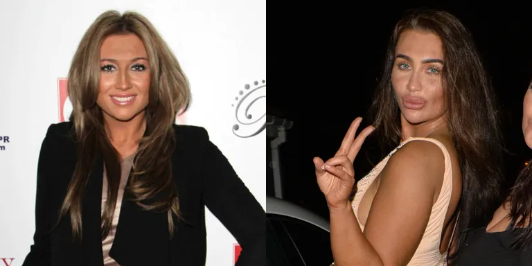 Vasakul: Lauren Goodger 2010. aastal (foto: Scanpix).Paremal: Lauren Goodger 2018. aastal (foto: Vida Press).