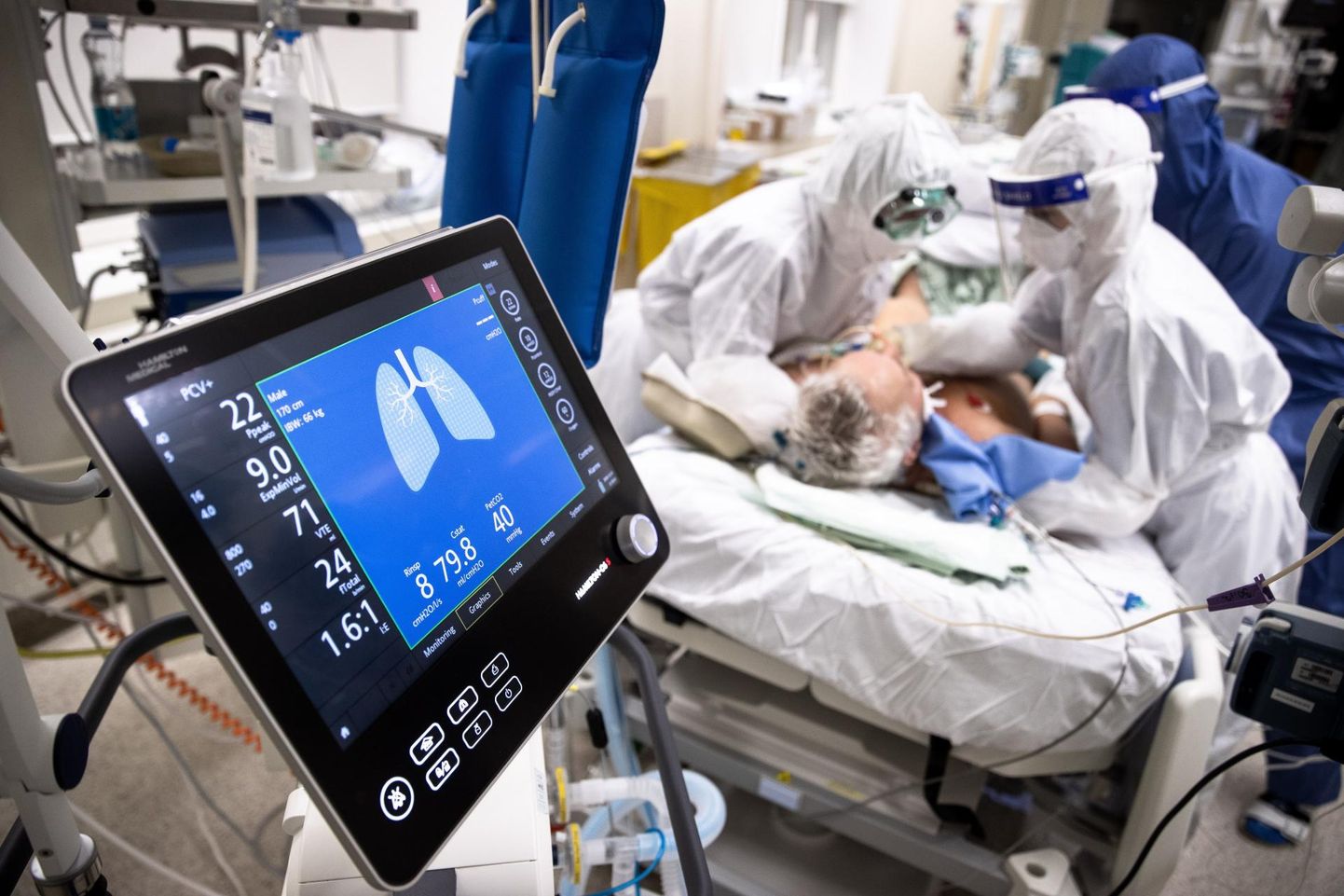 Pärnu haigla koroonaosakonna intensiivravi osakonnas vajab eilsest hingamisaparaadi tuge üks patsient.
 