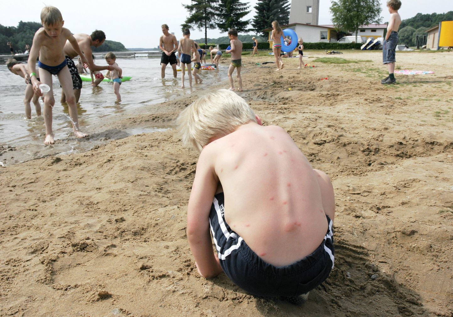 Viljandi järve ääres mänginud lapse nahale tekkis punetav lööve.