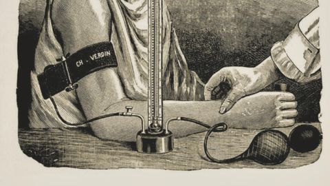 Kõrgvererõhktõbi: sümptomist haiguseks