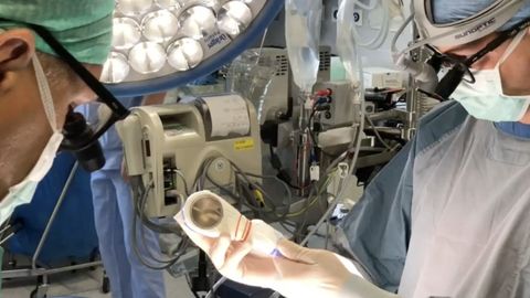 Austria arstid: panime südamelihase pärast keerukat operatsiooni üsna kiirelt taastuma – loe, kuidas nad seda tegid