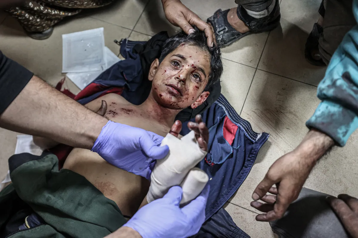 Haavatud poissi ravitakse al-Aqsa haiglas Deir al-Balahis pärast Iisraeli rünnakut al-Maghazi põgenikelaagrile. Laagri elanikkond kolmekordistus sõja esimestel kuudel. Gaza, 1. jaanuar 2024. Lääne-, Kesk- ja Lõuna-Aasia, fotolood.