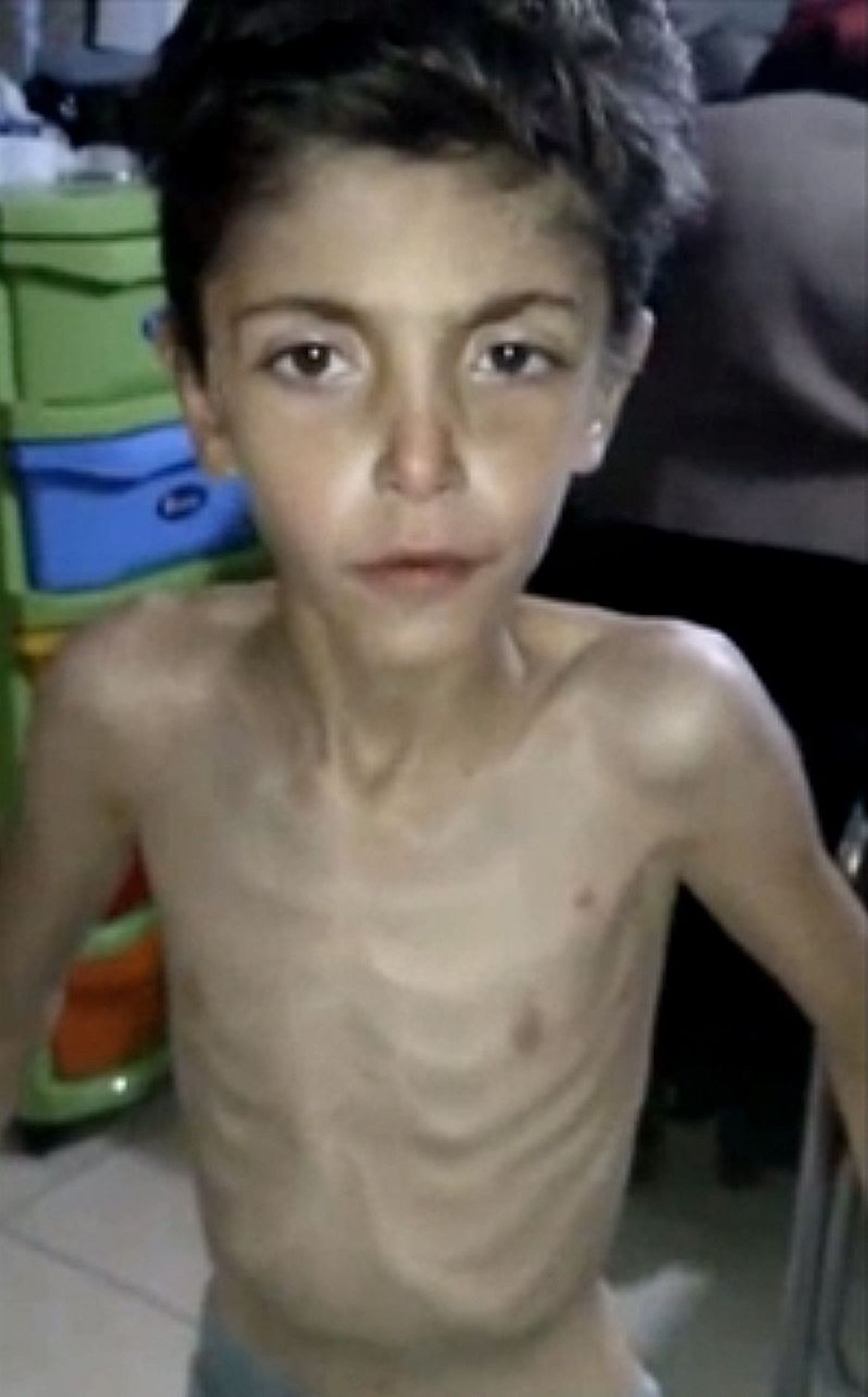 Alatoitunud Süüria poiss
