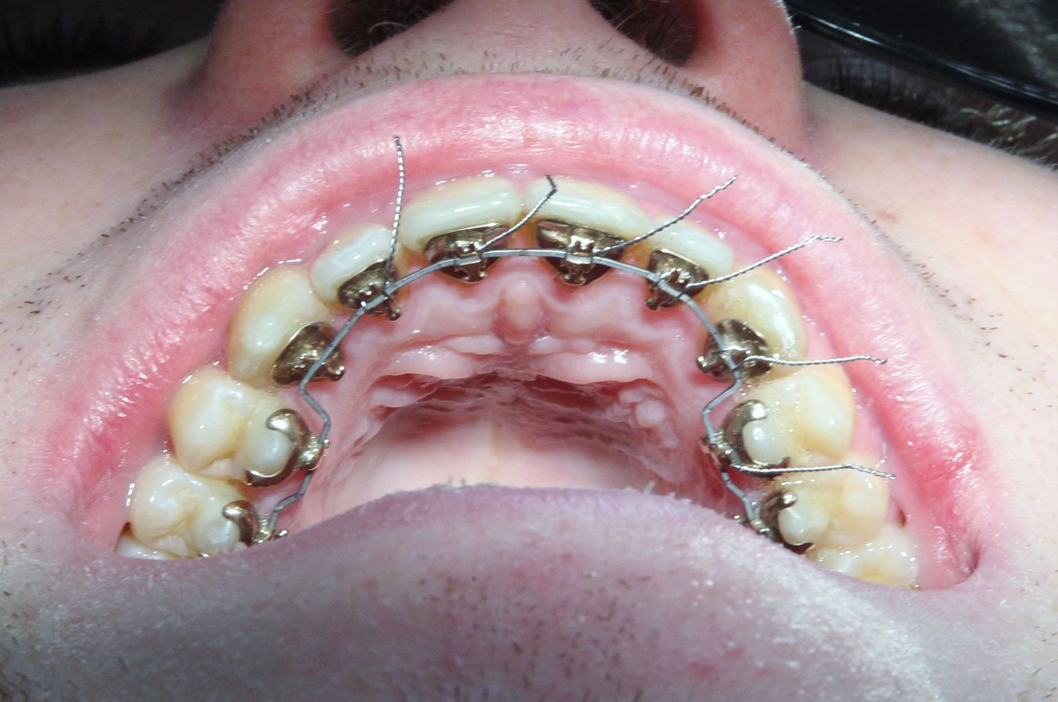 Ortodondid sätivad hambarea korda.