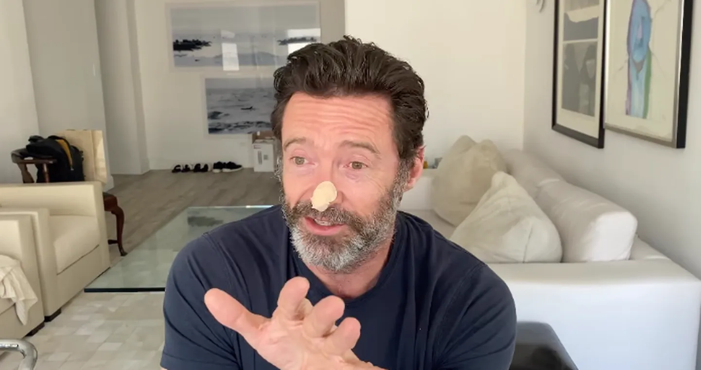 Hugh Jackman kutsus inimesi üles oma naha tervisele mõtlema.