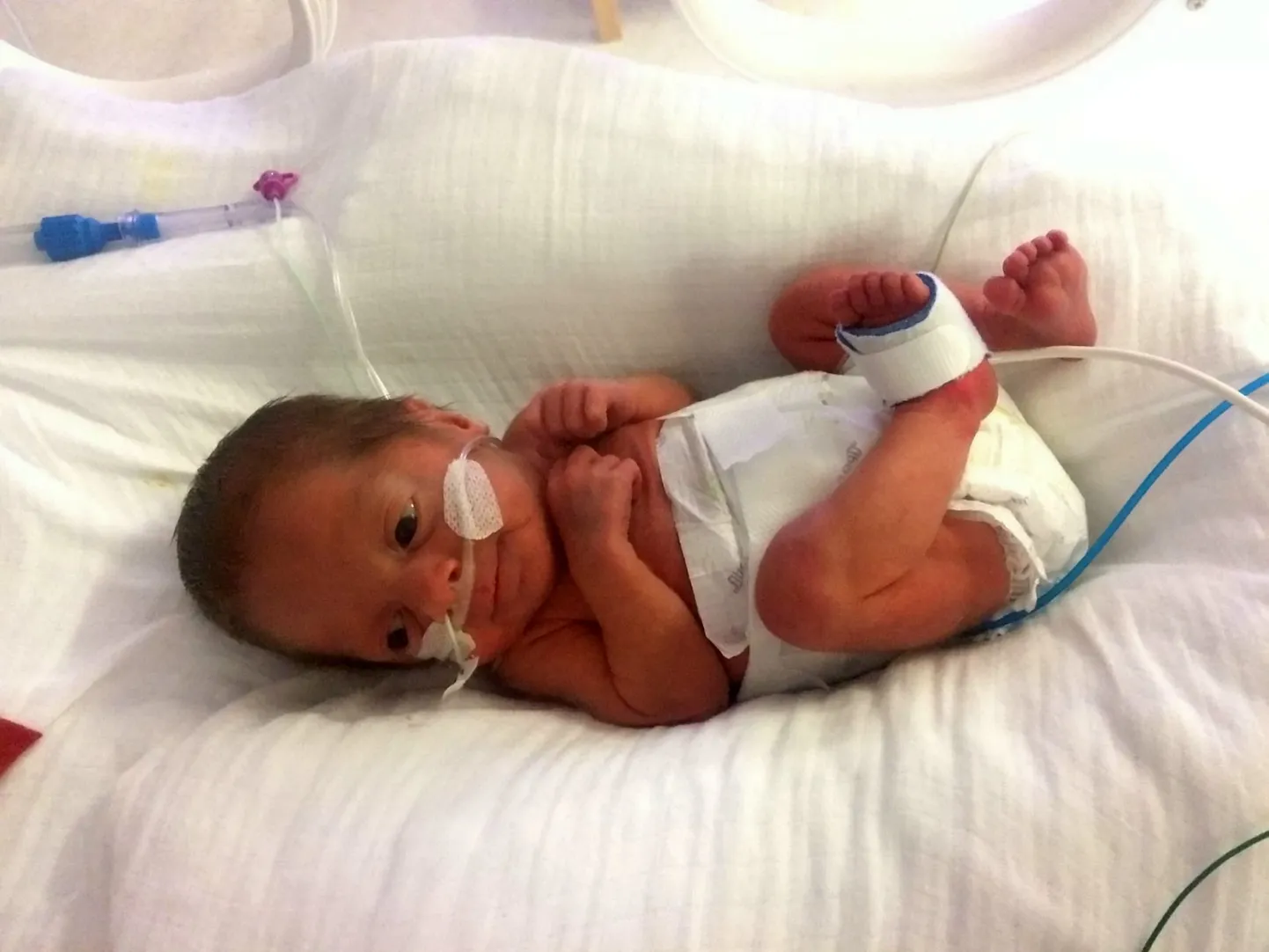 Harrison peaaegu kolm kuud pärast sündi. Nii suur oleks ta pidanud olema sündides.