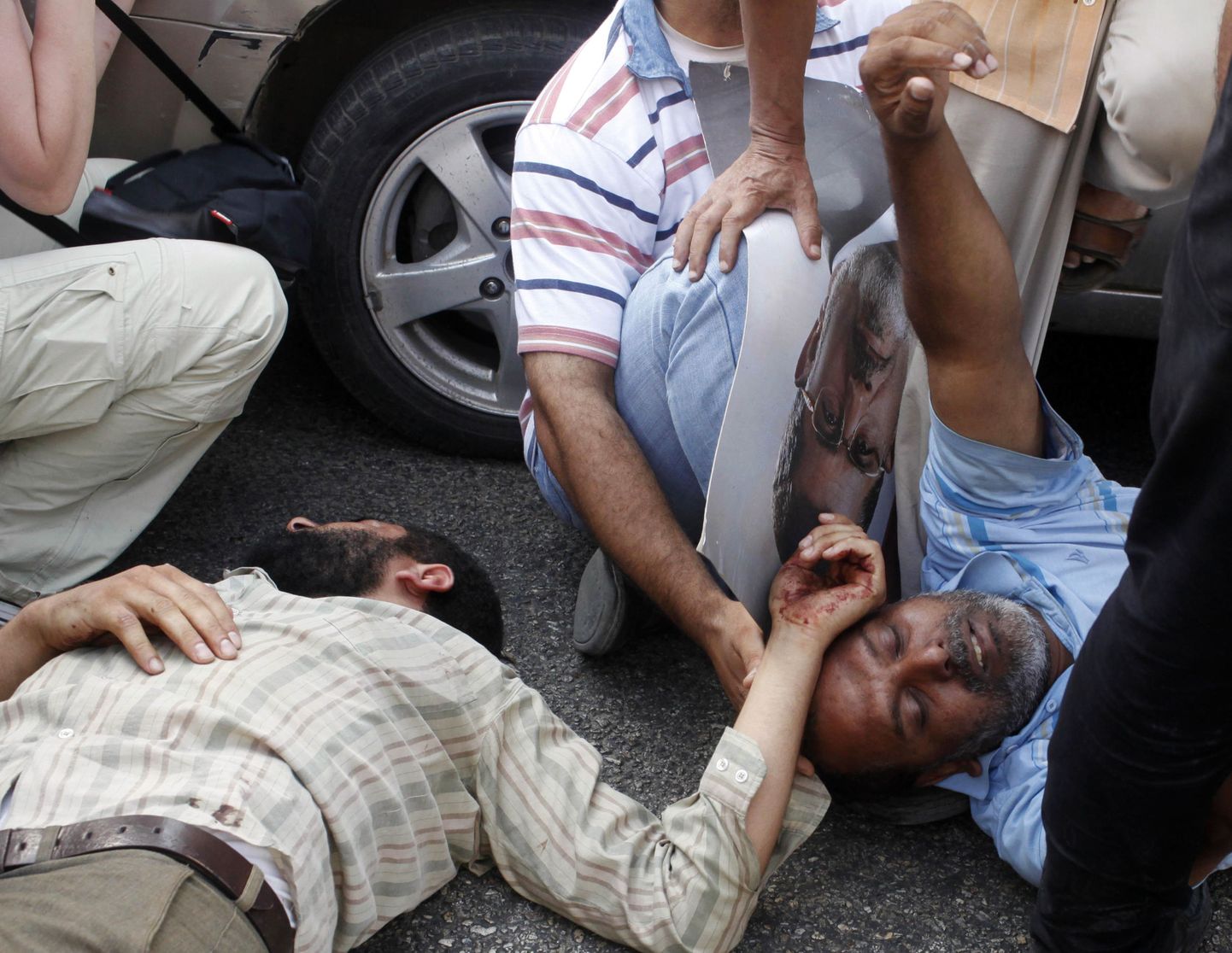 Vigastatud meeleavaldajad, kes tulid avaldama toetust kukutatud presidendile Mohamed Morsile.