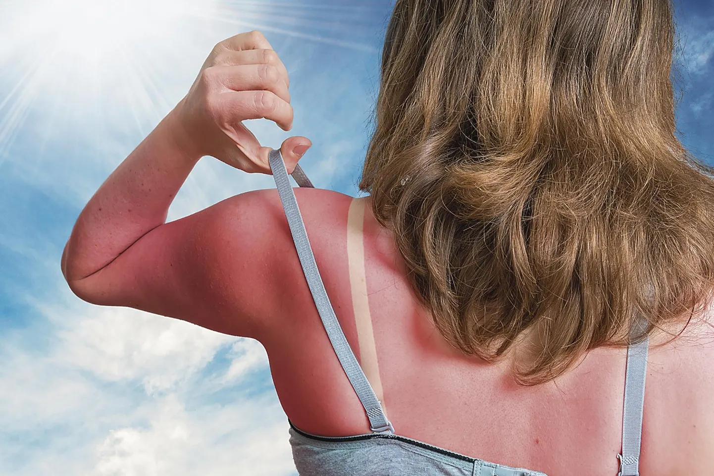 Ehkki ohutut päevitamist pole olemas, soovitab naha­arst, et kui inimene siiski otsustab randa päikest püüdma minna, tuleks 20 minutit enne päikese kätte minekut määrida nahale päikesekaitsekreemi.
