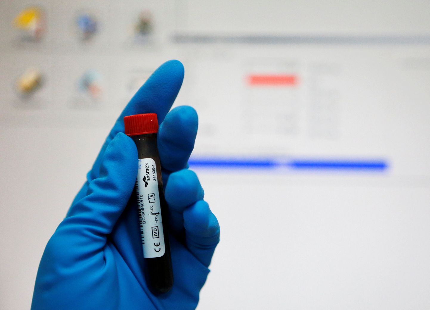 Проба крови в антидопинговой лаборатории России.