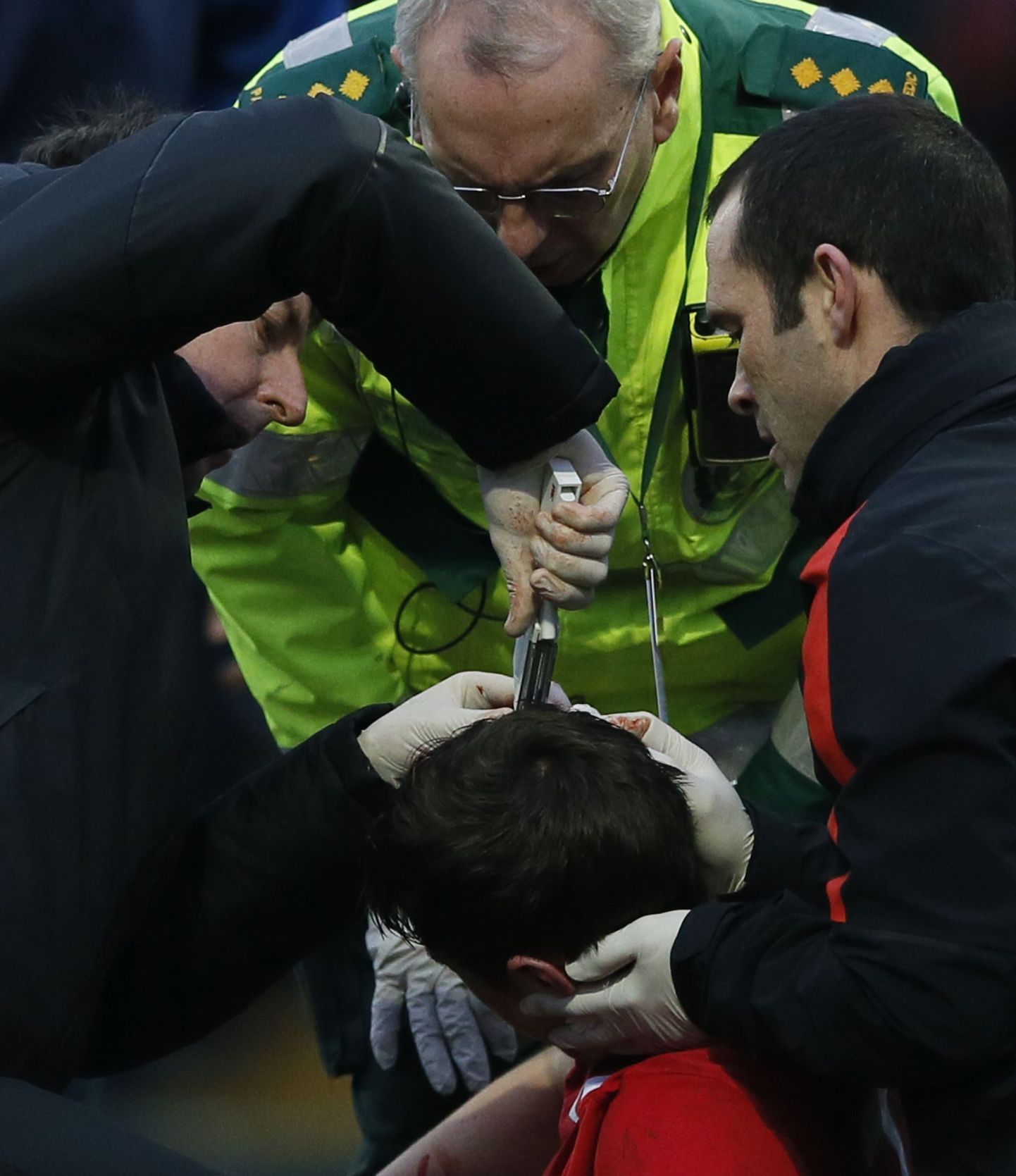 Manchester Unitedi arstid klammerdasid Paddy McNairi peahaava kokku.